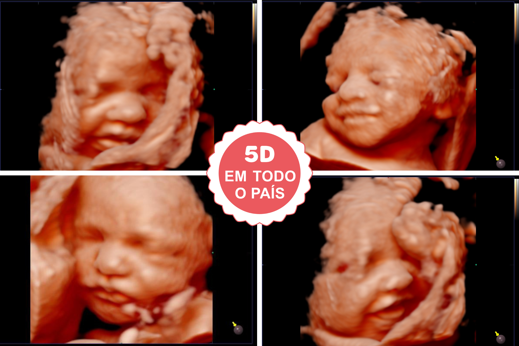 MMBB - Imagens artigosnotícias (5)